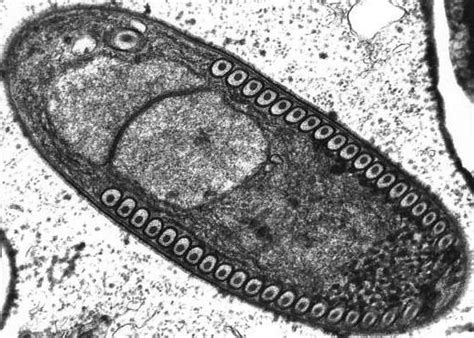  Mikrosporidia! Mikroskopijne pasożyty o niesamowitej strategii przeżycia!