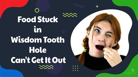 How to Know if Food is Stuck in Wisdom Tooth Hole: A Journey Through Culinary Catastrophes and Dental Dilemmas