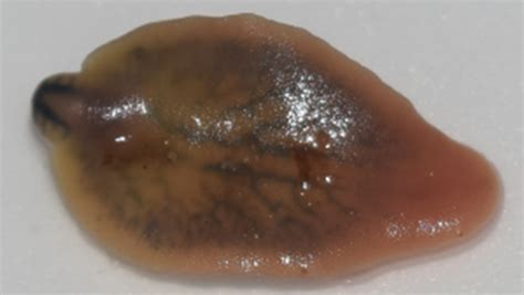  Liver Fluke: The Tiny Terror That Can Travel Miles Through Your Body!