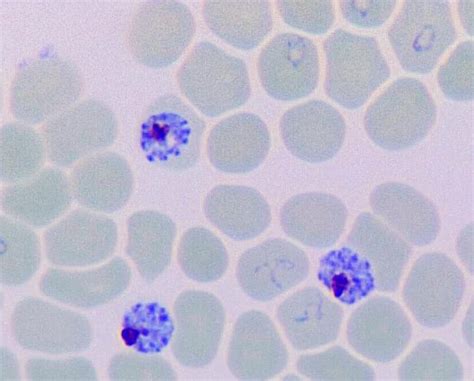  Plasmodium! A Microscopic Terror That Turns Your Blood into a Buffet