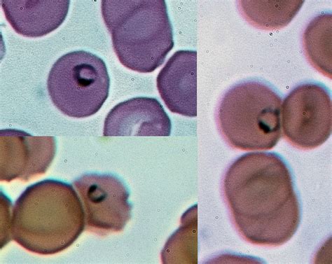  Plasmodium -  Mały pasożyt, który potrafi przewrócić cały świat!