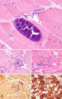 Sarcocystis –  a parasitic protist that infects muscles but lurks in the shadows as an enigmatic inhabitant!